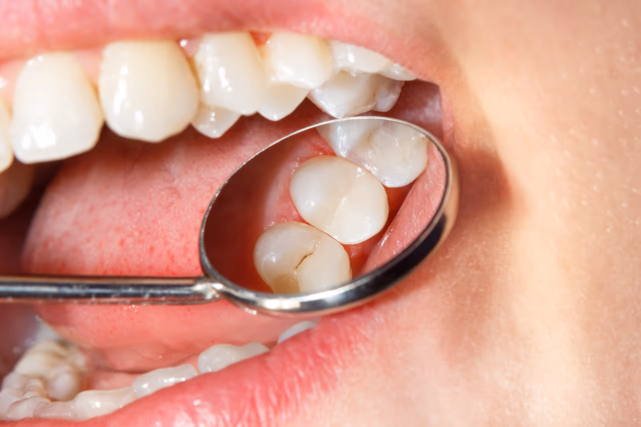 Sealants